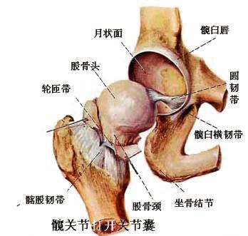 无菌性股骨头坏死