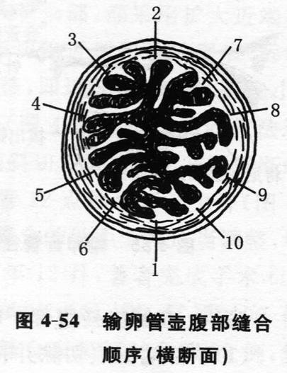 中华输卵管专业网