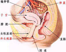 盆腔淤血综合症