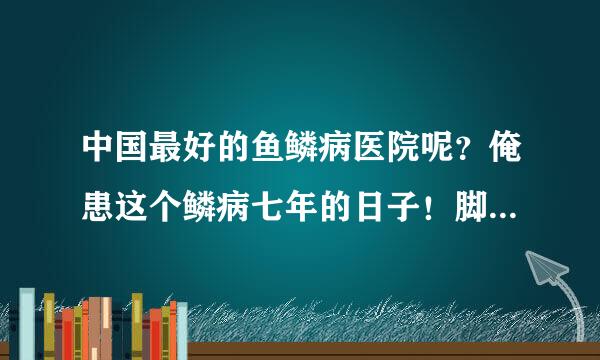 中国最好的鱼鳞病医院呢？俺患这个鳞病七年的日子！脚上分布很多鳞片！皮肤总是很粗