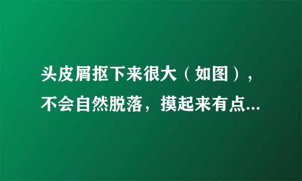 头皮屑抠下来很大（如图），不会自然脱落，摸起来有点硬然后就抠下来，但头皮不痒，而且我隔天洗头一次，