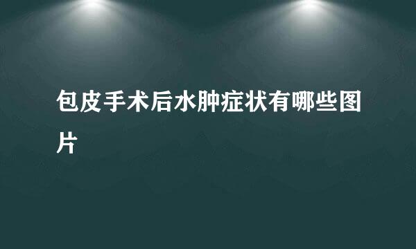 包皮手术后水肿症状有哪些图片