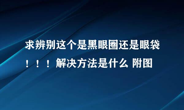 求辨别这个是黑眼圈还是眼袋！！！解决方法是什么 附图