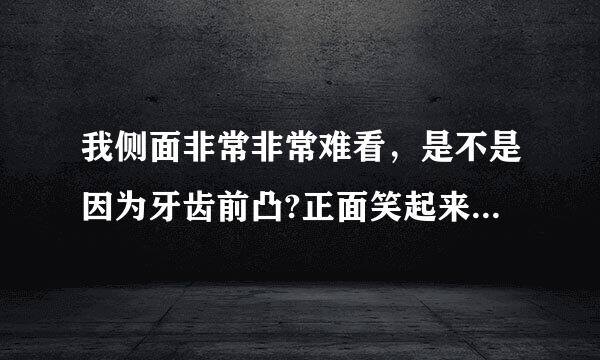 我侧面非常非常难看，是不是因为牙齿前凸?正面笑起来可以掩饰图嘴凸