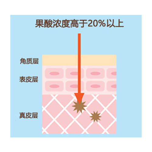 刷酸是什么意思？