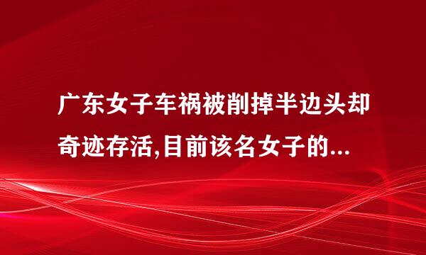 广东女子车祸被削掉半边头却奇迹存活,目前该名女子的情况如何了?