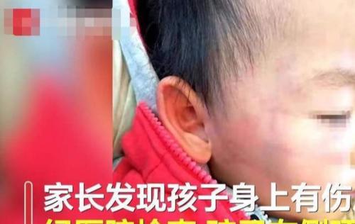 2岁男童两分钟遭老师掌掴8次，对于这样的老师你想说什么？