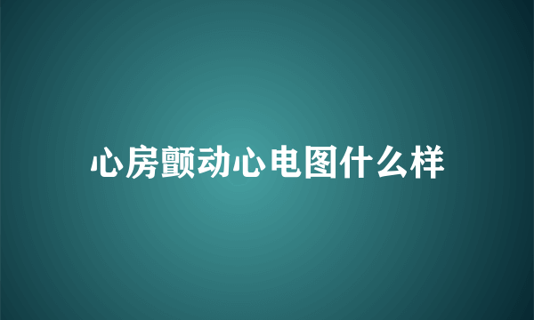 心房颤动心电图什么样