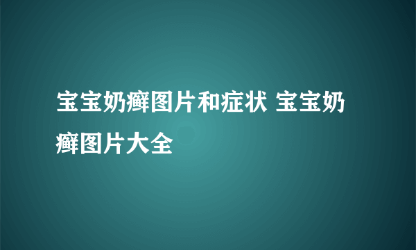 宝宝奶癣图片和症状 宝宝奶癣图片大全