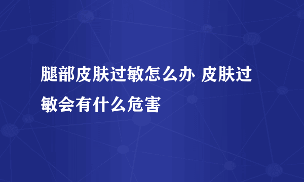 腿部皮肤过敏怎么办 皮肤过敏会有什么危害