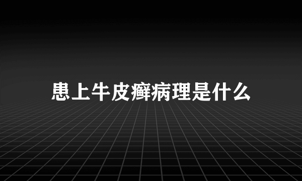 患上牛皮癣病理是什么