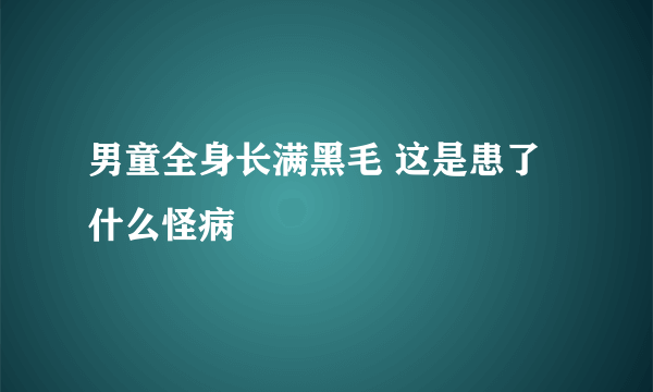 男童全身长满黑毛 这是患了什么怪病