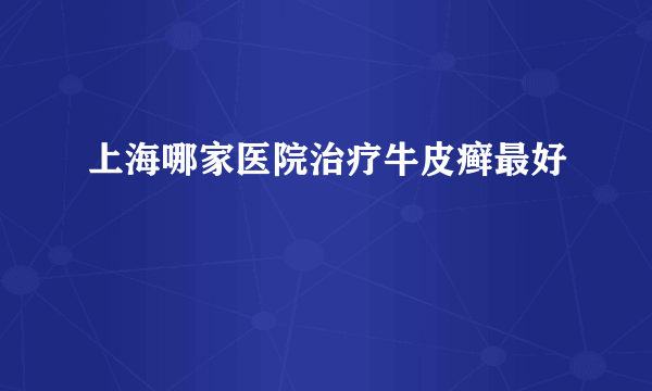 上海哪家医院治疗牛皮癣最好