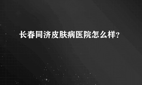 长春同济皮肤病医院怎么样？