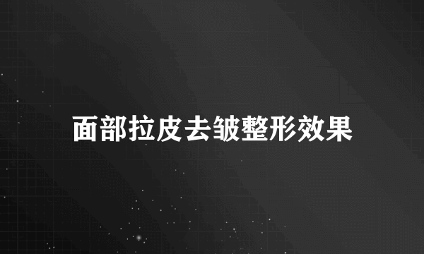 面部拉皮去皱整形效果