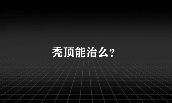 秃顶能治么？