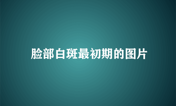  脸部白斑最初期的图片