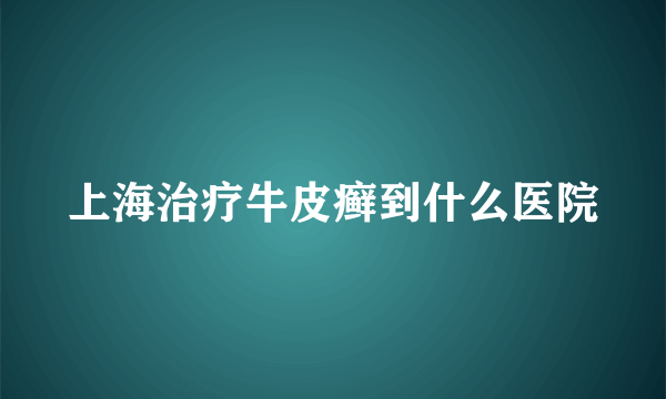 上海治疗牛皮癣到什么医院