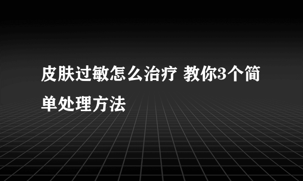 皮肤过敏怎么治疗 教你3个简单处理方法