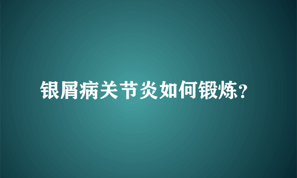 银屑病关节炎如何锻炼？