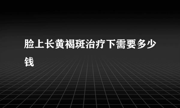 脸上长黄褐斑治疗下需要多少钱