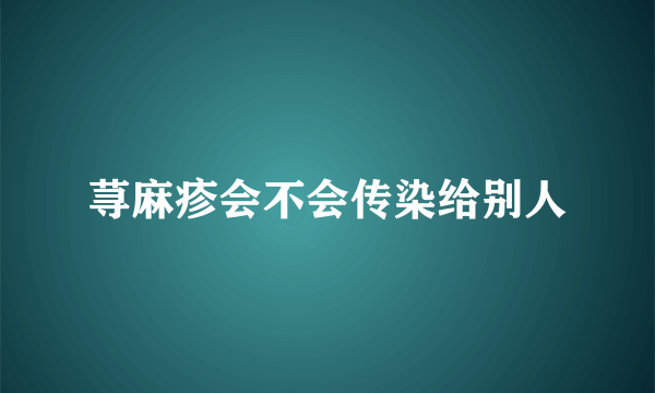 荨麻疹会不会传染给别人