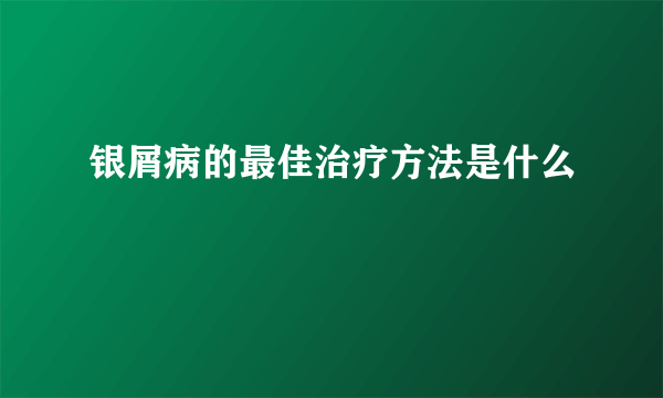 银屑病的最佳治疗方法是什么