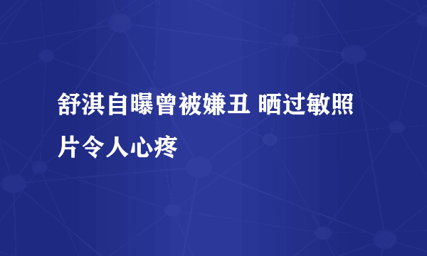 舒淇自曝曾被嫌丑 晒过敏照片令人心疼