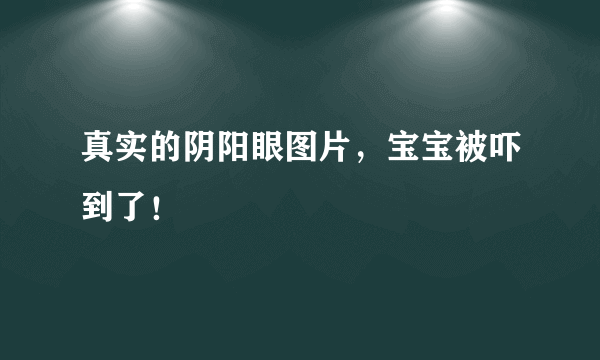 真实的阴阳眼图片，宝宝被吓到了！