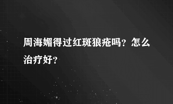 周海媚得过红斑狼疮吗？怎么治疗好？