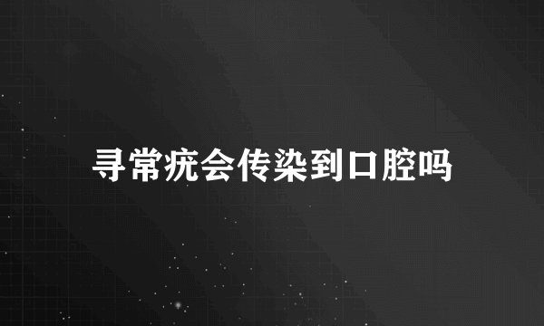 寻常疣会传染到口腔吗