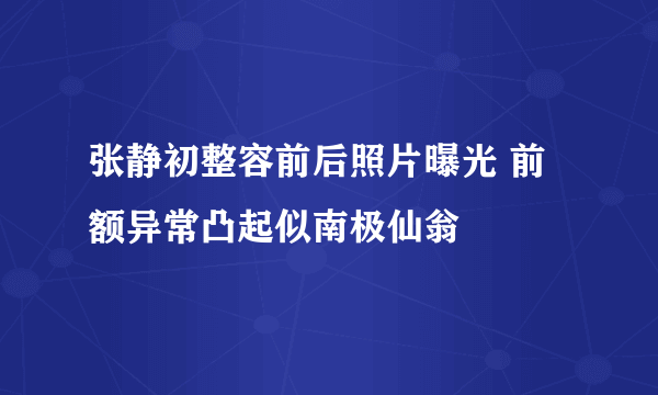 张静初整容前后照片曝光 前额异常凸起似南极仙翁