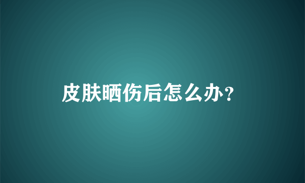 皮肤晒伤后怎么办？