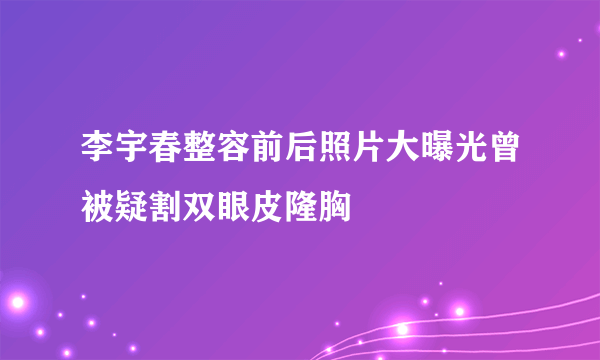 李宇春整容前后照片大曝光曾被疑割双眼皮隆胸