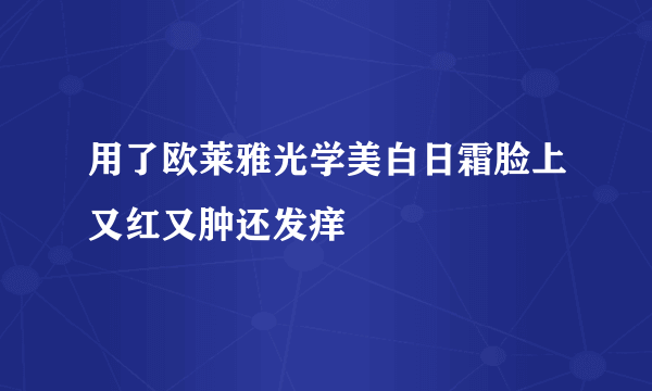 用了欧莱雅光学美白日霜脸上又红又肿还发痒