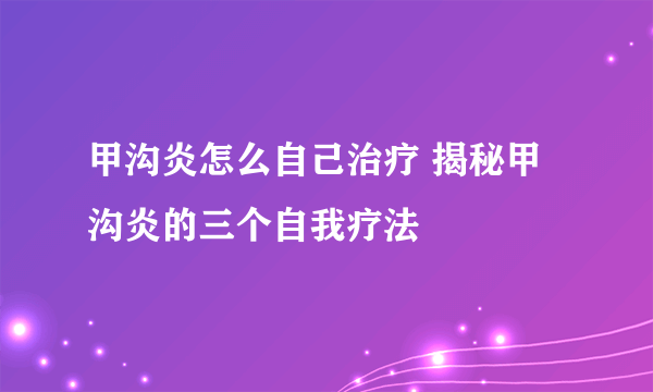 甲沟炎怎么自己治疗 揭秘甲沟炎的三个自我疗法