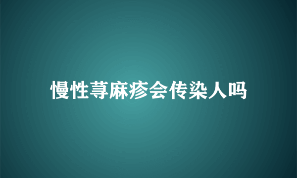 慢性荨麻疹会传染人吗