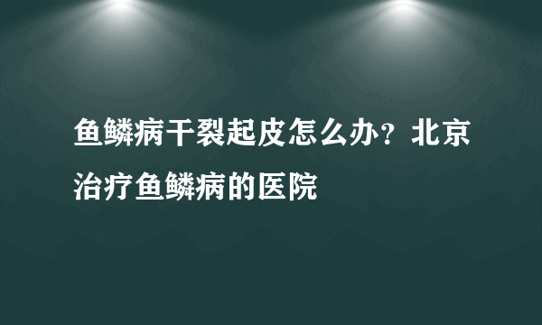 鱼鳞病干裂起皮怎么办？北京治疗鱼鳞病的医院