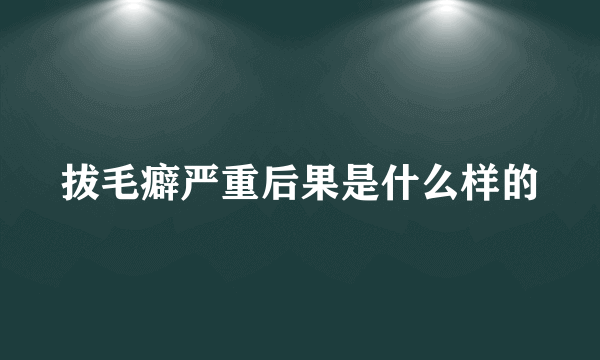 拔毛癖严重后果是什么样的