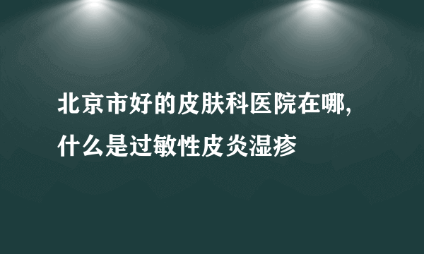 北京市好的皮肤科医院在哪,什么是过敏性皮炎湿疹