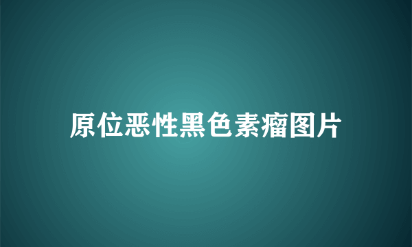 原位恶性黑色素瘤图片