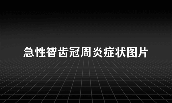 急性智齿冠周炎症状图片