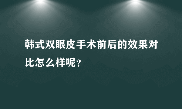 韩式双眼皮手术前后的效果对比怎么样呢？